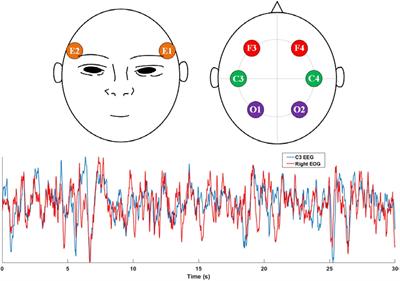 EOGNET: A Novel Deep Learning Model for Sleep Stage Classification Based on Single-Channel EOG Signal